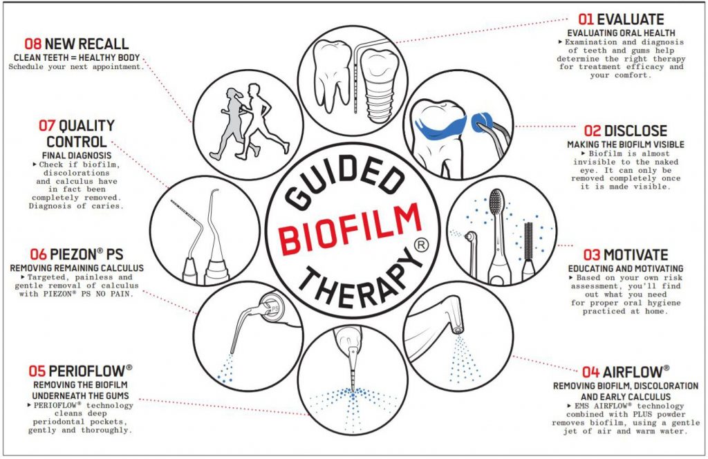 13 September 2021 Guided Biofilm Therapy Application in Teeth and