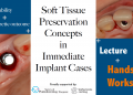 21 July 2024: Soft tissue preservation concepts in immediate implant cases